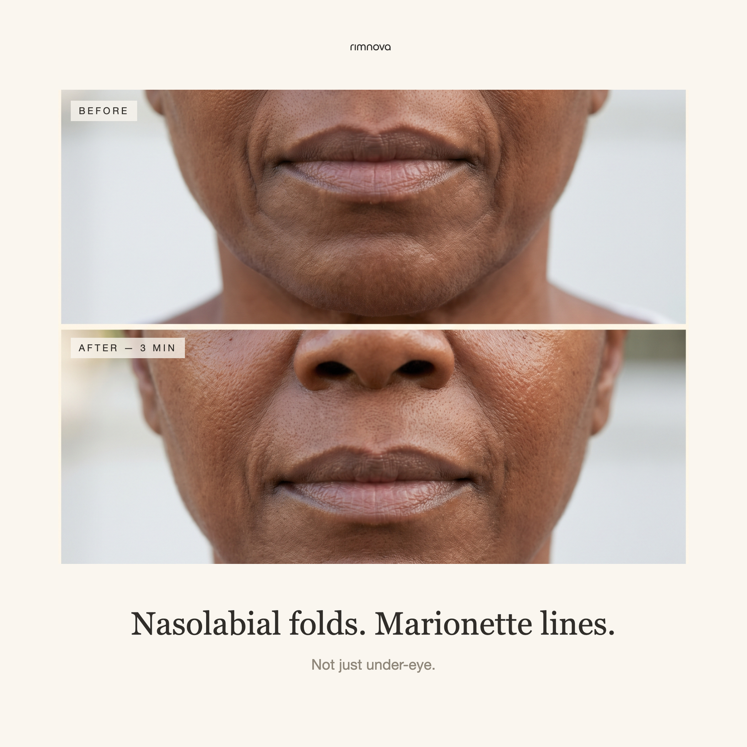 Line Smoother | Smooths Lines and Folds, Wears Under Makeup