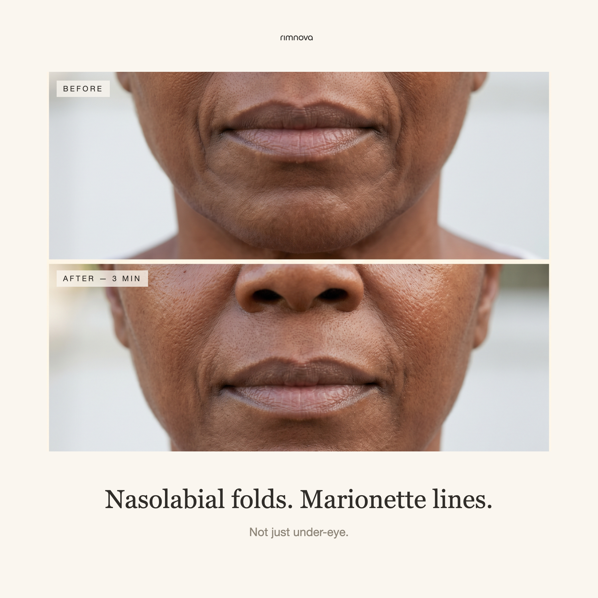Line Smoother | Smooths Lines and Folds, Wears Under Makeup
